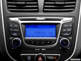  Stereo controls photo